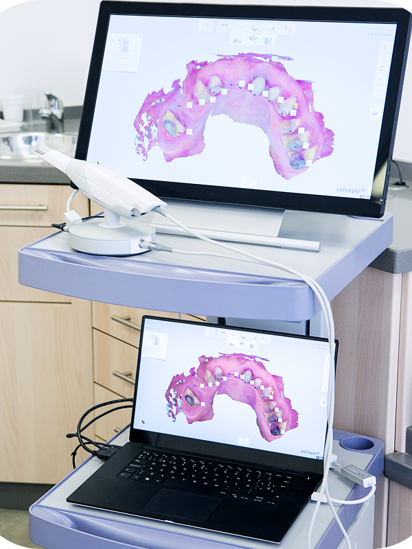 Digital Smile ScanThis quick and comfortable scan creates a 3D image of your teeth, helping visualise potential improvements before any dental treatment begins.